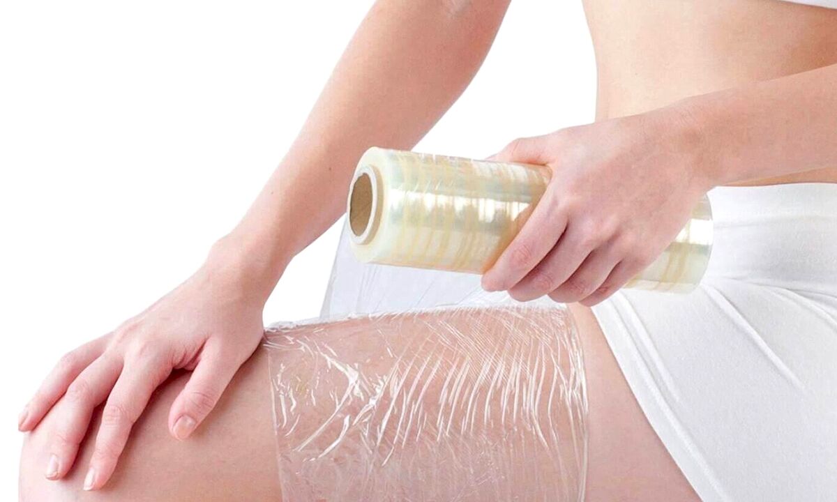 procedures